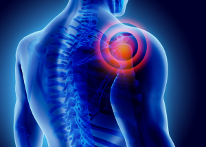 Exercises for Shoulder Pain: A Guide to Relief and Recovery