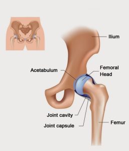 What’s Causing Your Hip Pain?