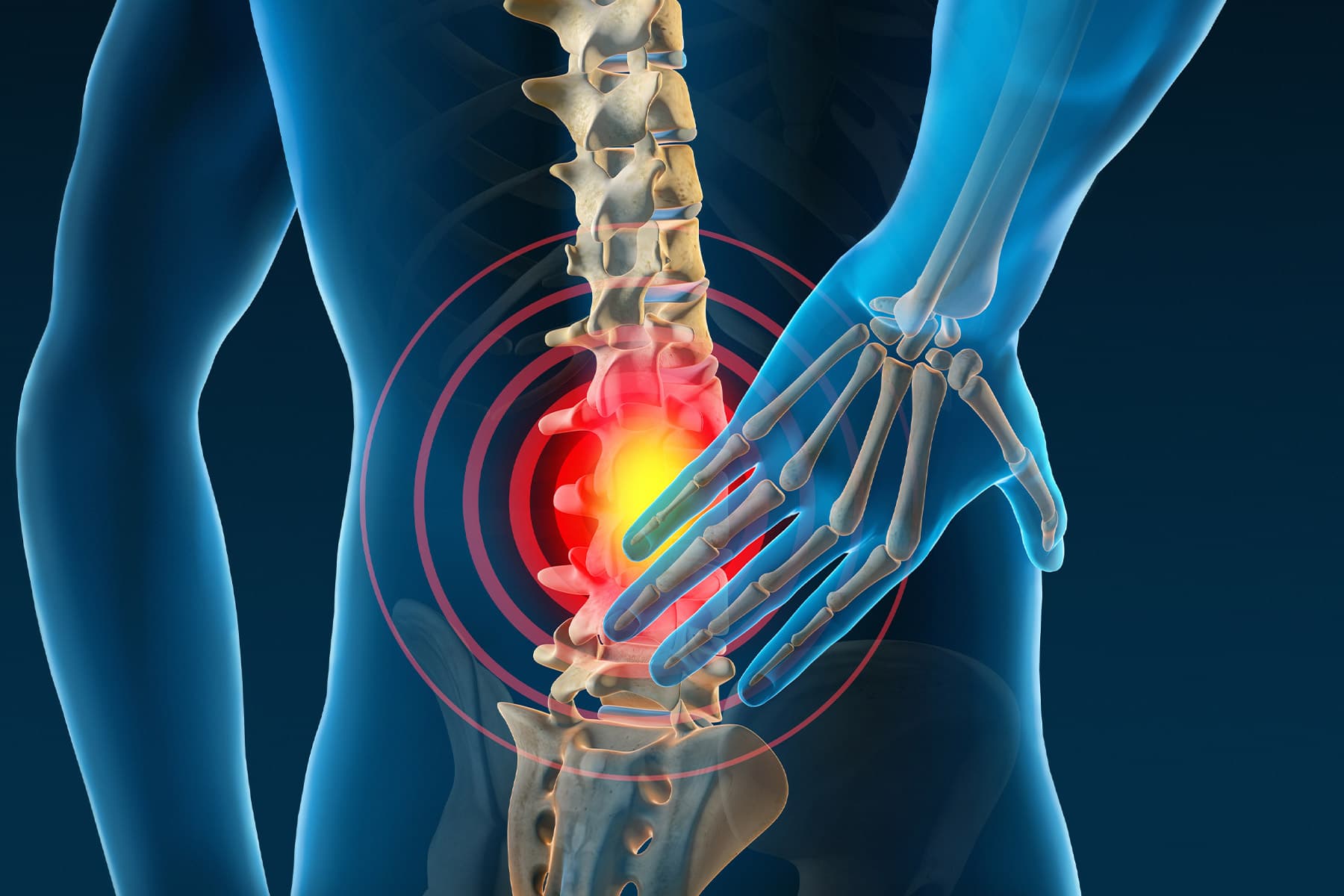 The Ultimate Guide to Understanding Chronic Back Pain