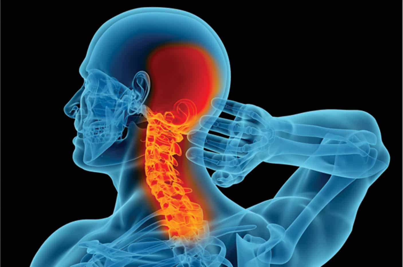 Understanding Cervical Disc Problems and Neck Pain