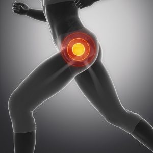 Fix That Hip Pain Fast