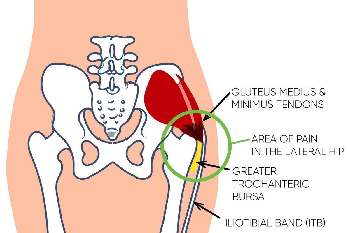Fix That Hip Pain Fast