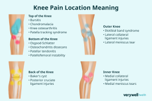 Knee Pain: Top Causes