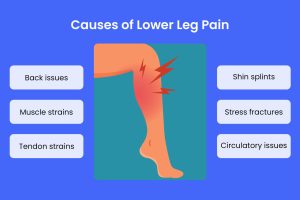 What’s Causing Your Leg Pain?
