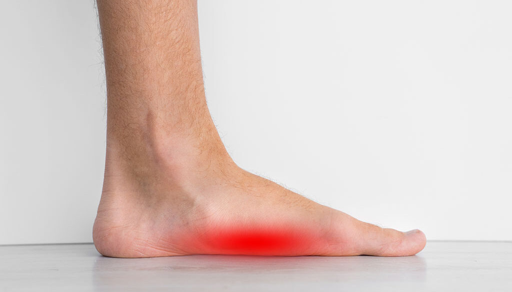 Foot Pain and Flat Feet: What You Should Know