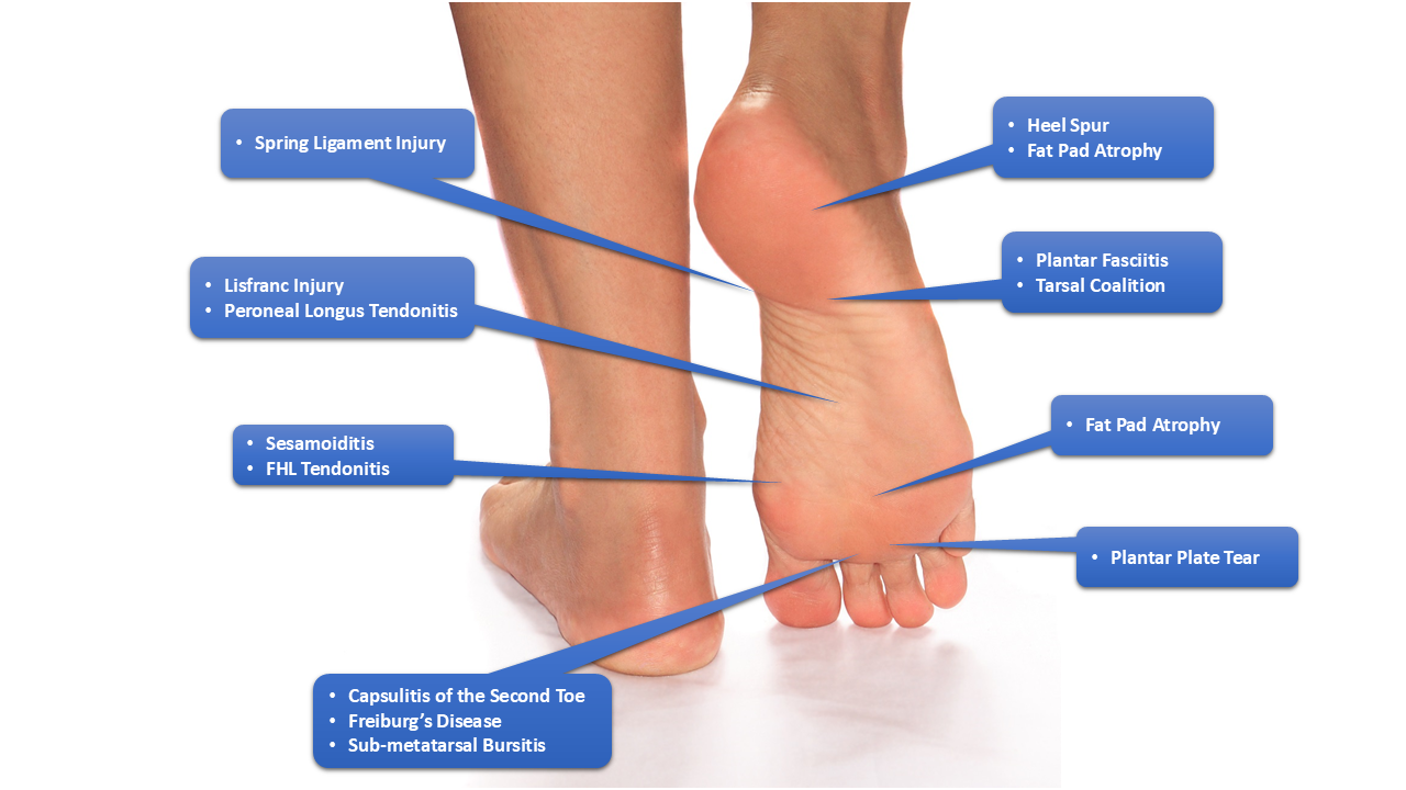 Heel to Toe: Pinpointing the Source of Your Foot Pain