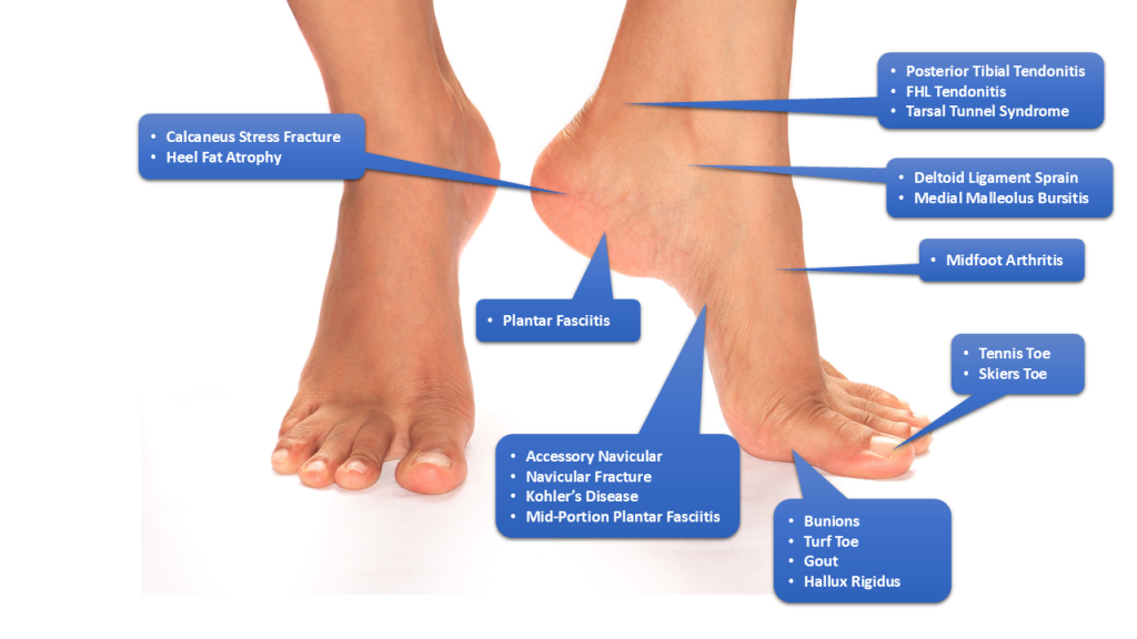 When to See a Podiatrist for Foot Pain