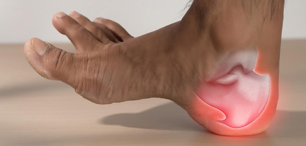 Plantar Fasciitis 101: Symptoms, Causes, and Treatments That Work