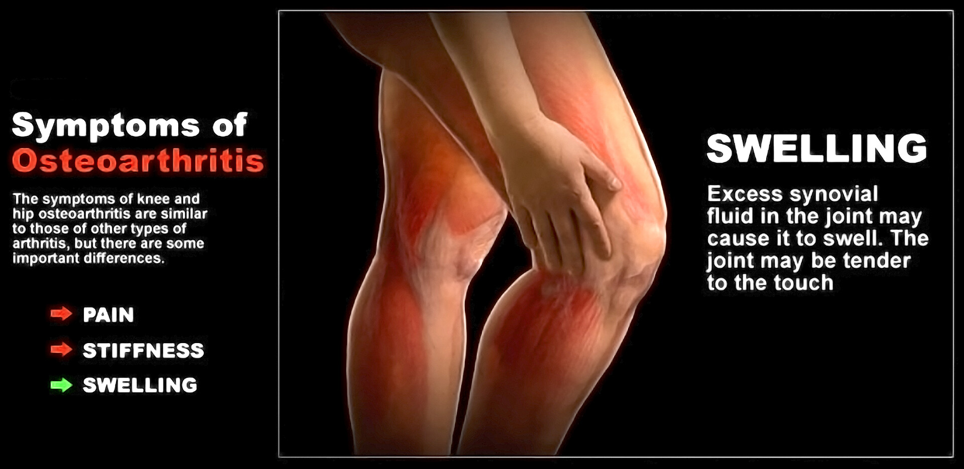 Understanding Joint Pain: Symptoms, Types, and When to Act