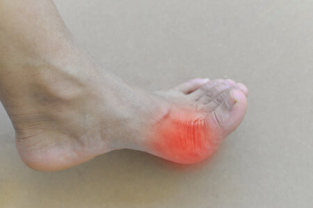 What That Pain in the Ball of Your Foot Really Means