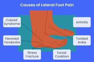 Why Do My Feet Hurt? 10 Common Causes of Foot Pain Explained Why Do My Feet Hurt? 10 Common Causes of Foot Pain Explained