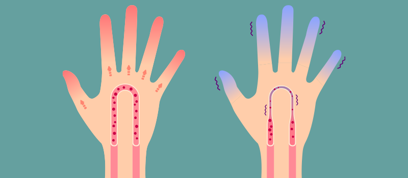 From Head to Toe: How Poor Circulation Affects Your Entire Body