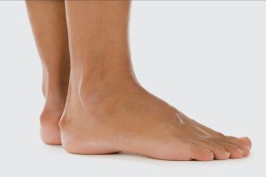 Heel Pain Relief: How to Treat the Most Common Causes