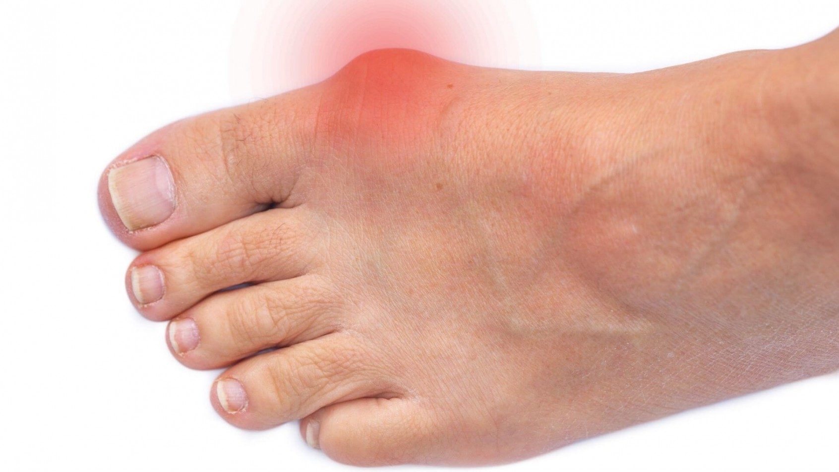 Treating Foot Pain from Flat Feet, Bunions, and High Arches